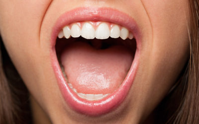 Laser Periodontal Treatment