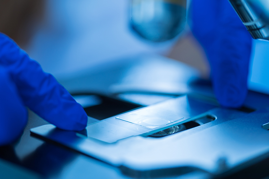Biopsy
